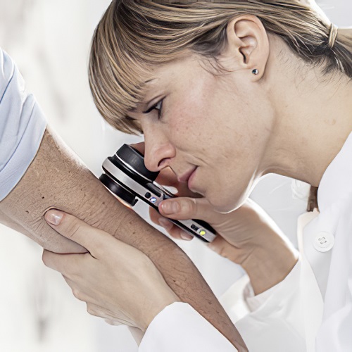 Hautkrebs-Screening & Dermatoskopie in der Allgemeinarztpraxis anbieten