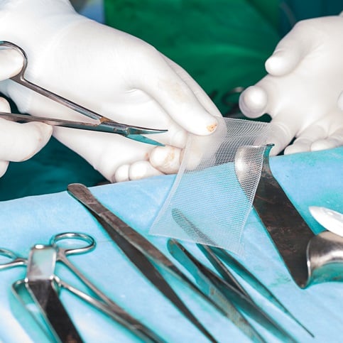 Ambulante Hernien-Operationen: Mehr Komfort, Effizienz & Sicherheit für Ihre Patienten