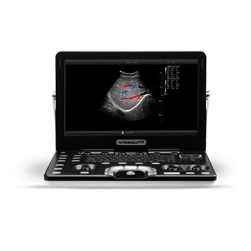 Ultraschallgeräte für die Sonografie beim Fachhandel bestellen